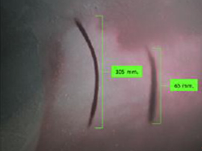 Figure 2 – On-site investigation